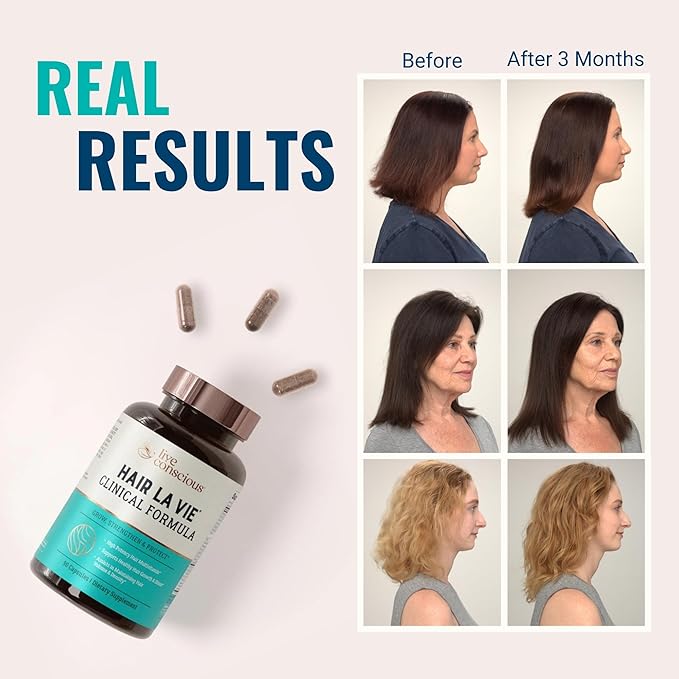 Hair La Vie Live Conscious Clinical Formula Hair Growth Vitamins for Women and Men w/Biotin 5000mcg, Collagen & Saw Palmetto (Pack of 1)