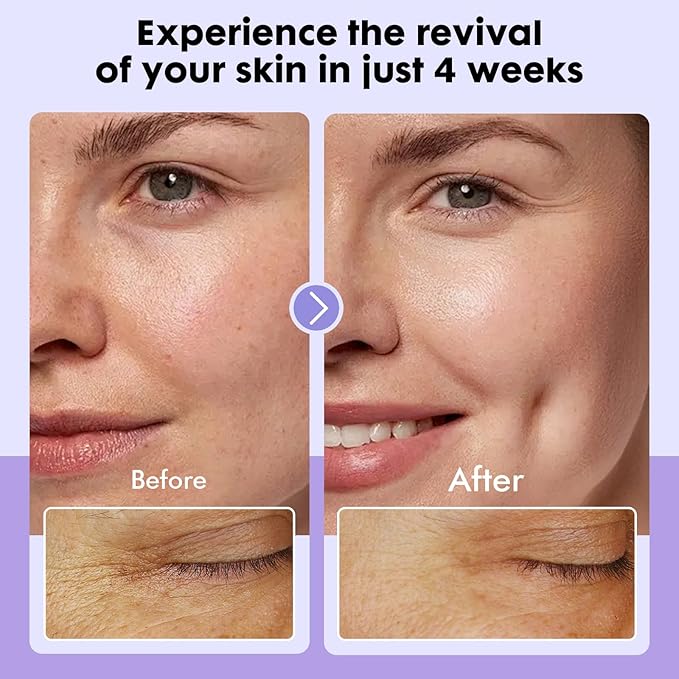 Dermasof Multi Peptide Power Serum for Face with Copper Peptides, Anti Aging, Firming and Lifting, Reduce Fine Lines and Wrinkles, Boost Collagen, Hydration, Barrier Repair, For All Skin Types 30mL