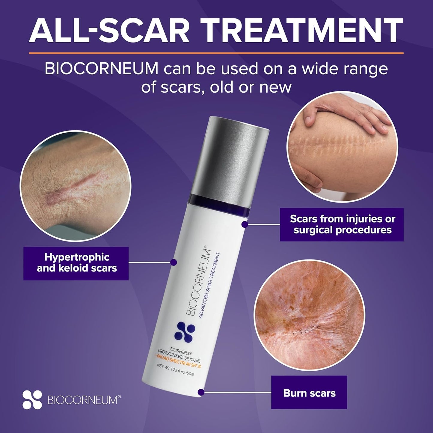 Advanced Scar Treatment with Silishield® & SPF 30 50g – Made in the USA, Fast-Drying, Water-Resistant Silicone Scar Gel - Surgeon Recommended for New & Old Scars - Suitable for Children Over 6 Months